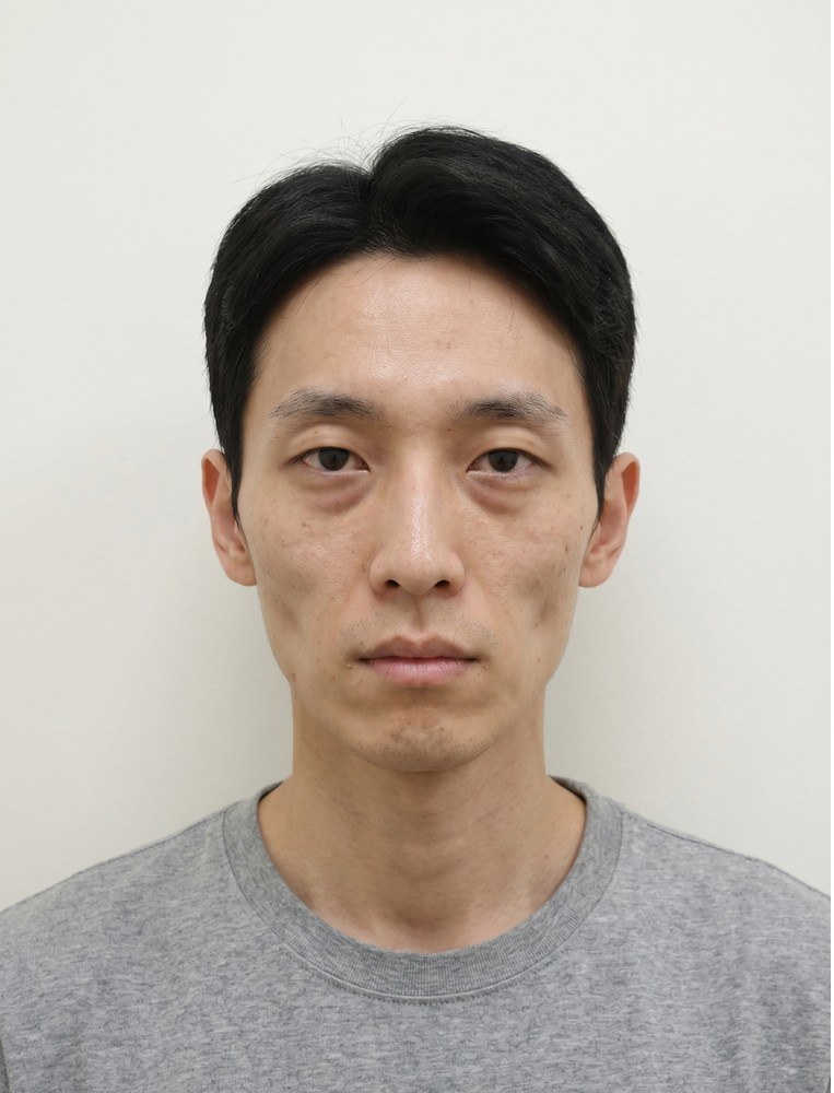 필러 before
