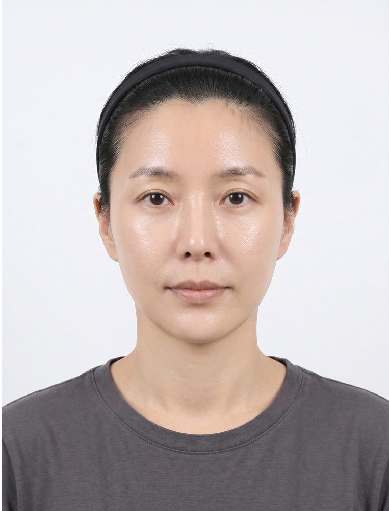 울쎄라 after