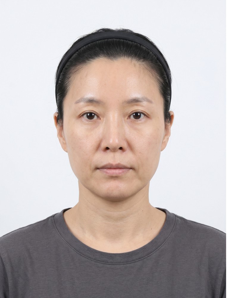 울쎄라 before