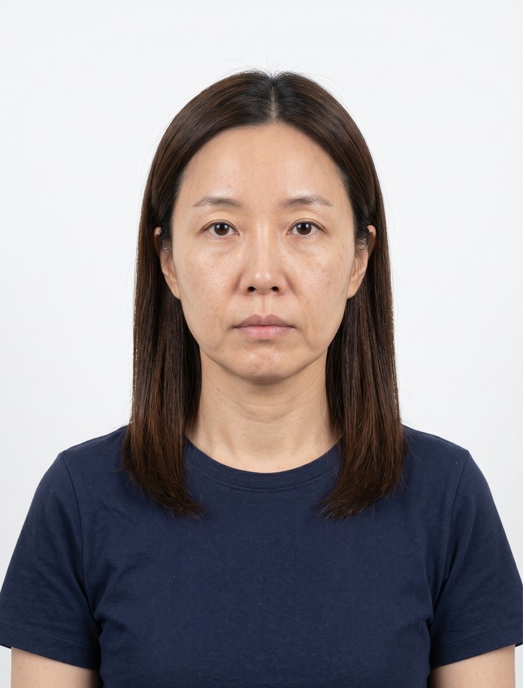울쎄라 before